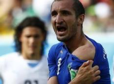 Chiellini-muestra-marcas-mordida-Luis-Suarez